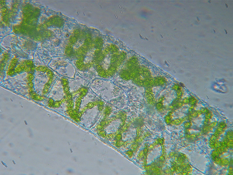 Coniugazione di Spirogyra